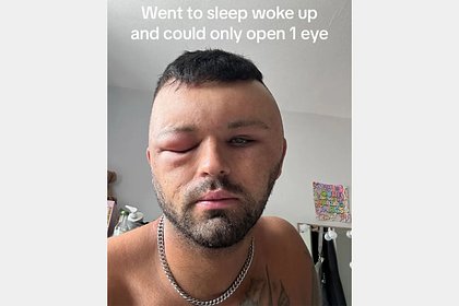      -   